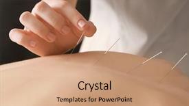  Presentation with acupuncture - Cool new slides with pain points - young woman undergoing acupuncture treatment backdrop and a coral colored foreground