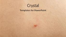  Presentation with skin - Colorful presentation theme enhanced with papilloma - human skin with birthmark closeup backdrop and a lemonade colored foreground