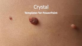  Presentation with skin - Slide deck consisting of papilloma - human skin with birthmarks closeup background and a coral colored foreground