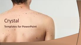  Presentation with light - Amazing presentation having papilloma - young man with birthmarks backdrop and a lemonade colored foreground