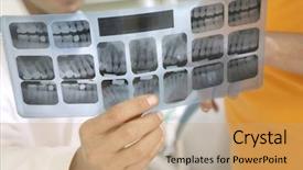  Presentation with dentist - Slides having patient examining x-ray background and a coral colored foreground