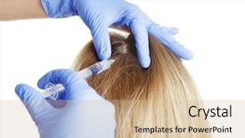  Presentation with hair loss - Beautiful slides featuring patient fall - young woman with hair loss backdrop and a soft green colored foreground