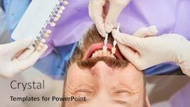  Presentation with teeth whitening - PPT layouts featuring patient-with-professional-teeth-whitening background and a coral colored foreground