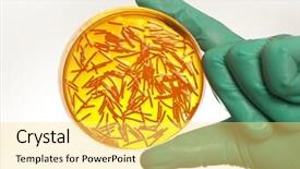  Presentation with petri dish - Slides enhanced with petri dish with virus cells background and a yellow colored foreground