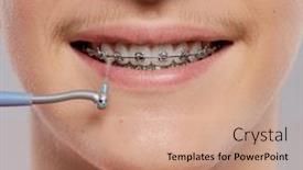  Presentation with dental hygiene - Amazing slides having photo-of-a-guy-cleaning backdrop and a coral colored foreground