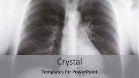  Presentation with human lung - Presentation theme consisting of picture of human male lung background and a light gray colored foreground