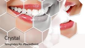  Presentation with abstract - Audience pleasing presentation design consisting of picture of woman's smile backdrop and a lemonade colored foreground