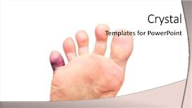  Presentation with problem statement problems and solutions - Slide deck enhanced with pinky - foot problems broken toe background and a pink colored foreground