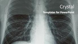  Presentation with normal - Audience pleasing PPT layouts consisting of plain-chest-x-ray-normal backdrop and a gray colored foreground