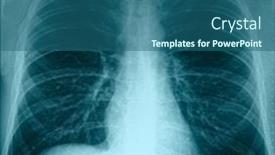  Presentation with lungs - Beautiful PPT layouts featuring plain-chest-x-ray-normal backdrop and a ocean colored foreground