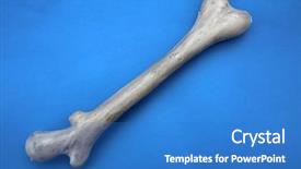  Presentation with bone anatomy - Slides consisting of plastic human bones halloween props background and a teal colored foreground