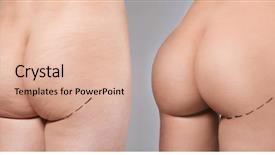  Presentation with plastic surgery - Amazing presentation theme having plastic surgery concept female body backdrop and a lemonade colored foreground