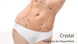  Presentation with plastic surgery - Presentation theme with plastic surgery concept female body background and a lemonade colored foreground