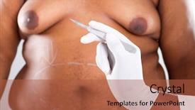  Presentation with plastic surgery - PPT layouts enhanced with plastic surgery for overweight african background and a red colored foreground