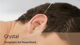  Presentation with ear pain - Slide set consisting of pain points - man's ear with needles acupuncture background and a coral colored foreground