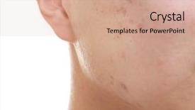  Presentation with skin care natural yellow and white - Colorful PPT theme enhanced with poren - young man with problem skin backdrop and a coral colored foreground