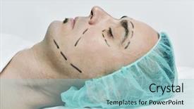  Presentation with plastic surgery - PPT layouts with pre operation - closeup of the head background and a light blue colored foreground