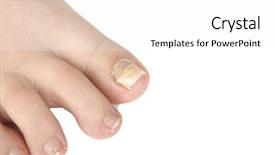  Presentation with finger nail - Beautiful PPT theme featuring preconstruction - reconstruction nail nail that went backdrop and a white colored foreground