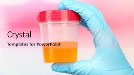  Presentation with urine - Audience pleasing slide set consisting of pregnant diabetes - medical urine test close-up backdrop and a lemonade colored foreground