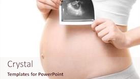  Presentation with ultrasound - Slides enhanced with pregnant woman holding ultrasound photo on white background closeup background and a lemonade colored foreground