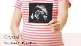  Presentation with ultrasound - PPT layouts featuring pregnant woman holding ultrasound photo on white background closeup background and a lemonade colored foreground