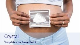  Presentation with ultrasound - Beautiful PPT theme featuring pregnant woman holding ultrasound scan on white background backdrop and a light blue colored foreground