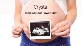  Presentation with ultrasound - Slide deck enhanced with pregnant woman showing ultrasound scans on white background background and a lemonade colored foreground