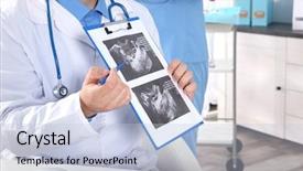  Presentation with baby ultrasound - Colorful PPT layouts enhanced with premature - doctor showing baby ultrasound image backdrop and a lemonade colored foreground