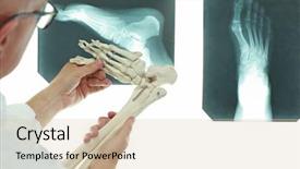  Presentation with professional - Presentation having tibia - professional with lower limb model background and a lemonade colored foreground