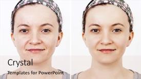  Presentation with skin and wound healing - Beautiful PPT layouts featuring puberty - woman with spotty skin backdrop and a lemonade colored foreground