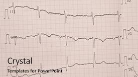  Presentation with heart beat - Colorful slide set enhanced with celerate - girl smiling and ringing bell backdrop and a light gray colored foreground.