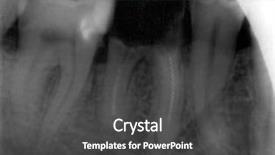  Presentation with xray - Presentation theme enhanced with radiograph teeth - forgotten tool in the broken background and a dark gray colored foreground