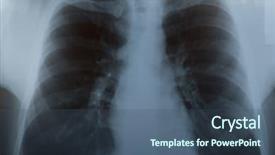  Presentation with lung - Slides consisting of radiography of lungs background and a ocean colored foreground