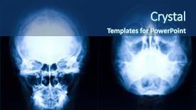  Presentation with xray - Amazing slide deck having radiologhy skull - blue image of head xray backdrop and a ocean colored foreground