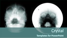  Presentation with children and trauma - Beautiful presentation featuring children's skull x-ray image backdrop and a ocean colored foreground