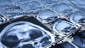  Presentation with trauma - Beautiful theme featuring radiology mri - typical sport trauma - injury backdrop and a teal colored foreground