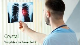  Presentation with lung cancer - Slide deck featuring ray image at hospital lung background and a sky blue colored foreground