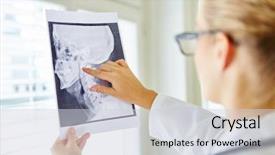  Presentation with oral surgery - Slides having ray image for oral surgery background and a light gray colored foreground