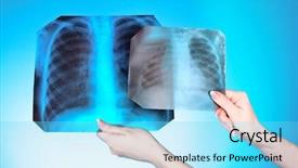  Presentation with chest - PPT theme enhanced with ray image of two chest background and a arctic colored foreground