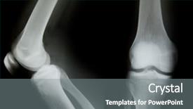  Presentation with knee - Colorful slides enhanced with ray of both human knee backdrop and a gray colored foreground