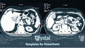  Presentation with kidney disease - Presentation theme enhanced with ray of the human kidney background and a ocean colored foreground