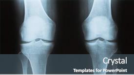  Presentation with knee - Presentation with ray of the knee femur background and a ocean colored foreground