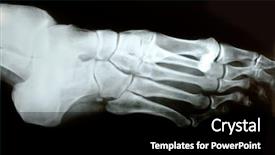  Presentation with human foot - Presentation theme with ray photograph of human foot background and a black colored foreground