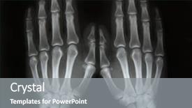  Presentation with black hand - PPT theme with ray picture of human hand background and a gray colored foreground