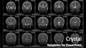  Presentation with brain mri - Slides featuring  background and a  colored foreground.