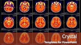  Presentation with minimal - Amazing slides having real brain mri slide backdrop and a tawny brown colored foreground