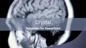 Presentation with angiogram - Amazing presentation design having real-mri-mra-magnetic-resonance backdrop and a seafoam green colored foreground