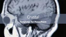  Presentation with angiogram - Colorful slide deck enhanced with real-mri-mra-magnetic-resonance backdrop and a gray colored foreground