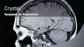  Presentation with angiogram - Slide deck featuring real-mri-mra-magnetic-resonance background and a black colored foreground