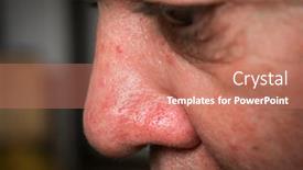  Presentation with veins - Audience pleasing theme consisting of red-veins-and-acne backdrop and a coral colored foreground